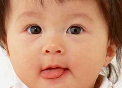 Ӥ���۾��¹�Ӧ�����ҽ��ͼ��